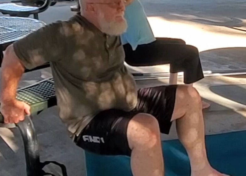 Outdoor exercise session at Active Healing Dallas FT Worth, Watauga, Texas, US, featuring bench dips.