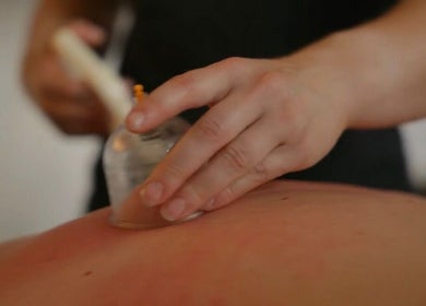 Cupping therapy at Evolution Of Fitness Sports Massage And Injury Clinic, Coventry, England, GB.