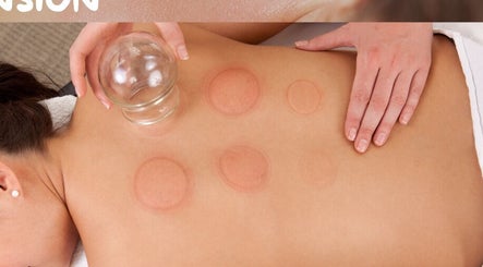 Cupping therapy at Therapeutic Massage by Kelly Murphy, Dallas, Pennsylvania, US enhances relaxation and healing.