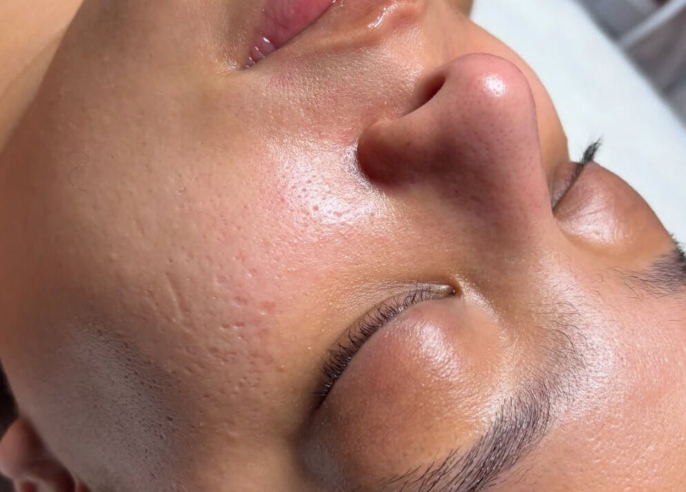 Close-up of a client's glowing, smooth skin at Brows Ave, Yonkers, New York, US.