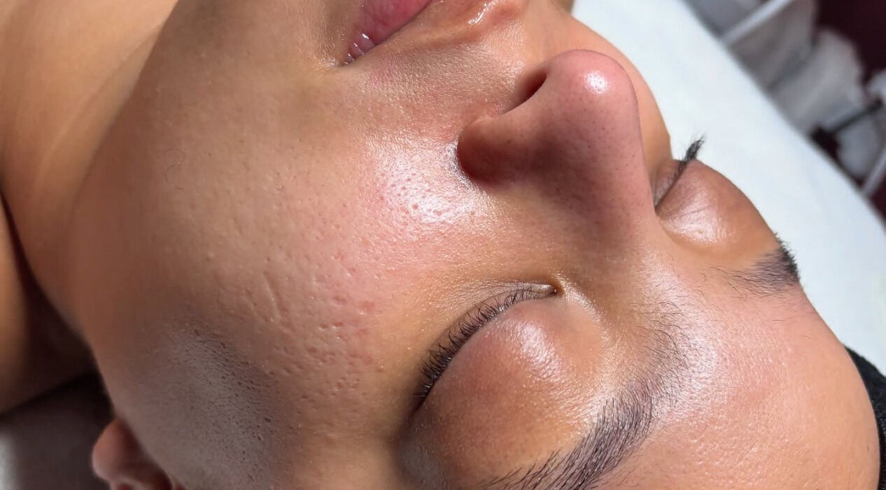 Close-up of a client's glowing, smooth skin at Brows Ave, Yonkers, New York, US.