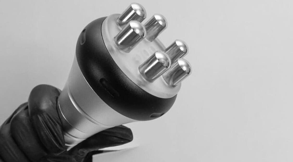 Dispositivo de tratamiento en Adriana Zullo MESOSKIN, Barcelona, Catalunya, ES.