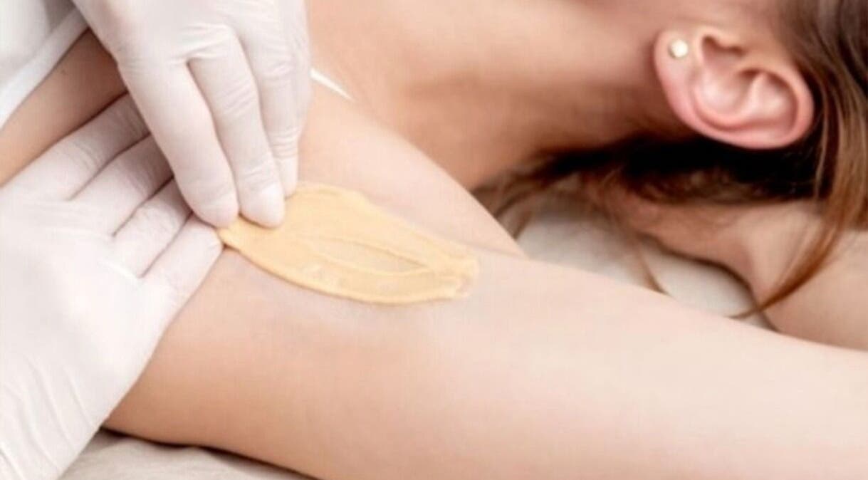 Depilación en Adriana Zullo MESOSKIN, Barcelona, Catalunya, ES. Manos aplicando cera suave en axila.