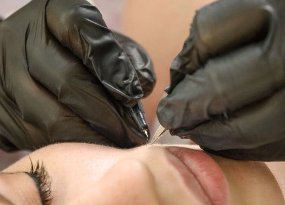 Tratamiento de precisión en Adriana Zullo MESOSKIN, Barcelona, Catalunya, ES.