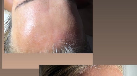 Tratamiento facial en Camila beauty spa, CW, mostrando piel lisa y brillante.