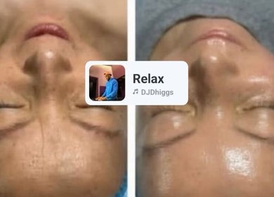 Before and after facial treatment at CKB SKIN CLINIC, Glasgow, Scotland, GB showing smoother skin results.