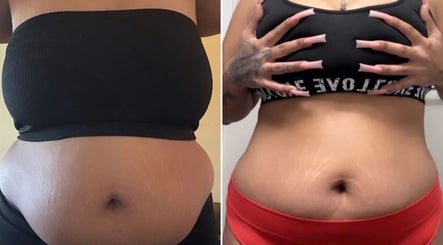 Before and after body contouring at Uncaged by Coach Dani, Aurora, Colorado, US.