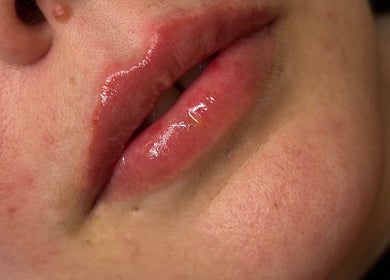 Close-up of glossy lips after treatment at Sims Beauty in Stilton, England, GB.