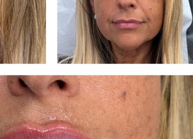 Close-up of a woman's rejuvenated skin after a facial at Face Harmony in Newmarket, Ontario, CA.
