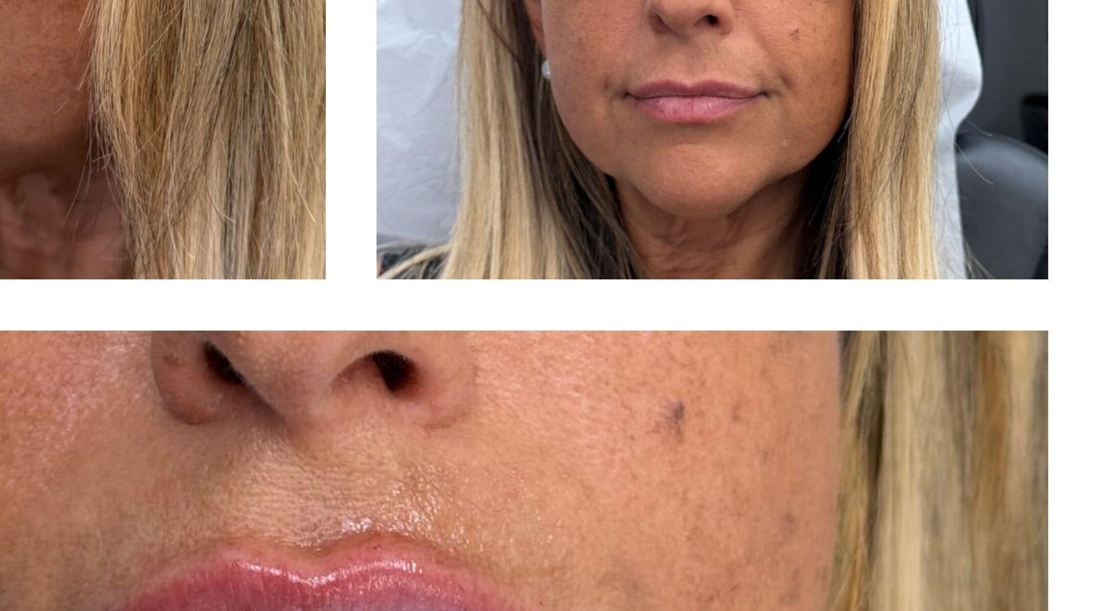 Close-up of a woman's rejuvenated skin after a facial at Face Harmony in Newmarket, Ontario, CA.