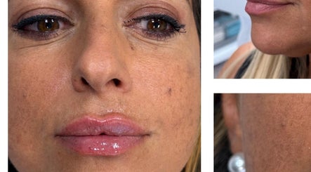 Close-up of rejuvenated skin at Face Harmony, Newmarket, Ontario, CA highlighting flawless complexion.