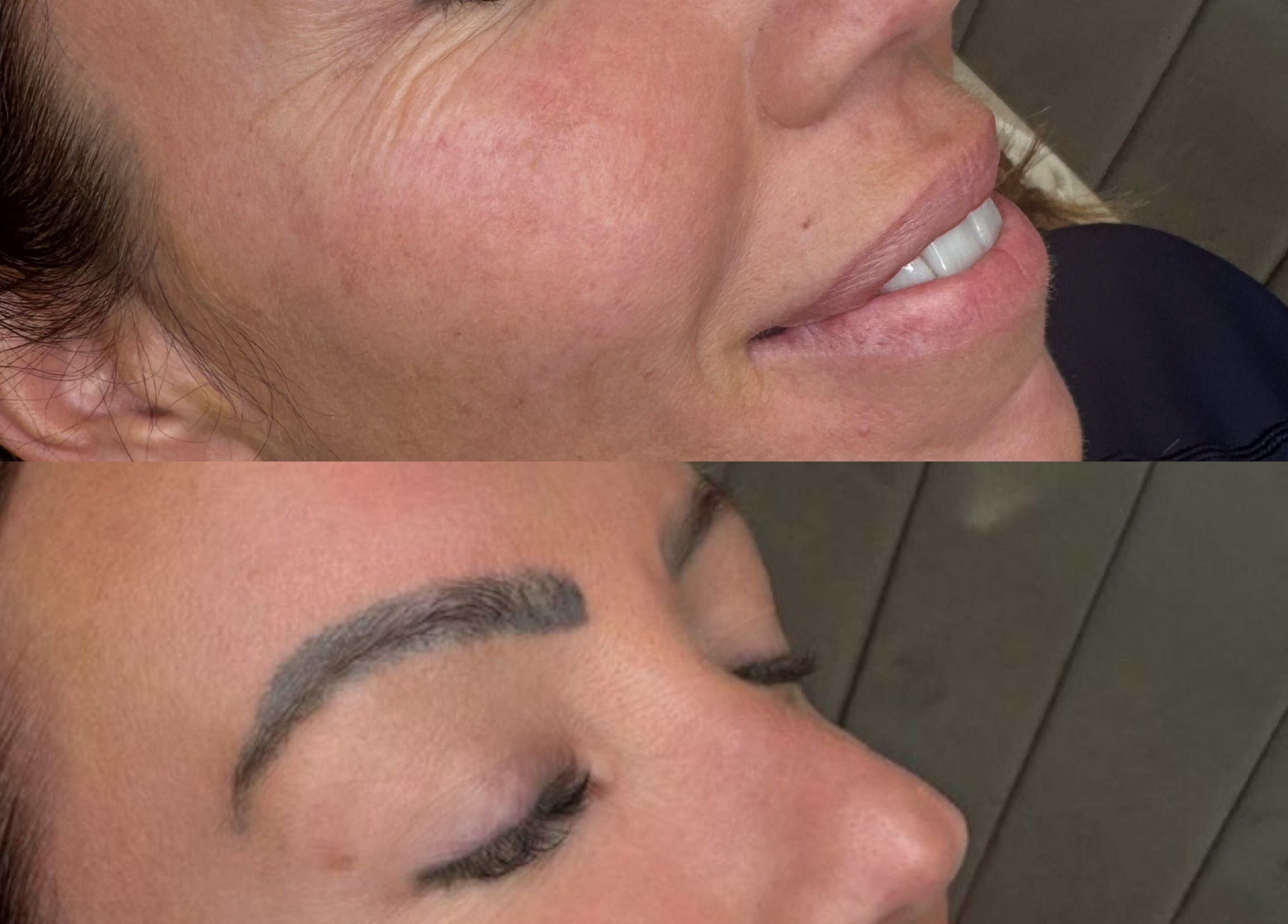 Before and after skin treatment at Glowology clinic, Bolton, England, GB highlighting improved complexion.