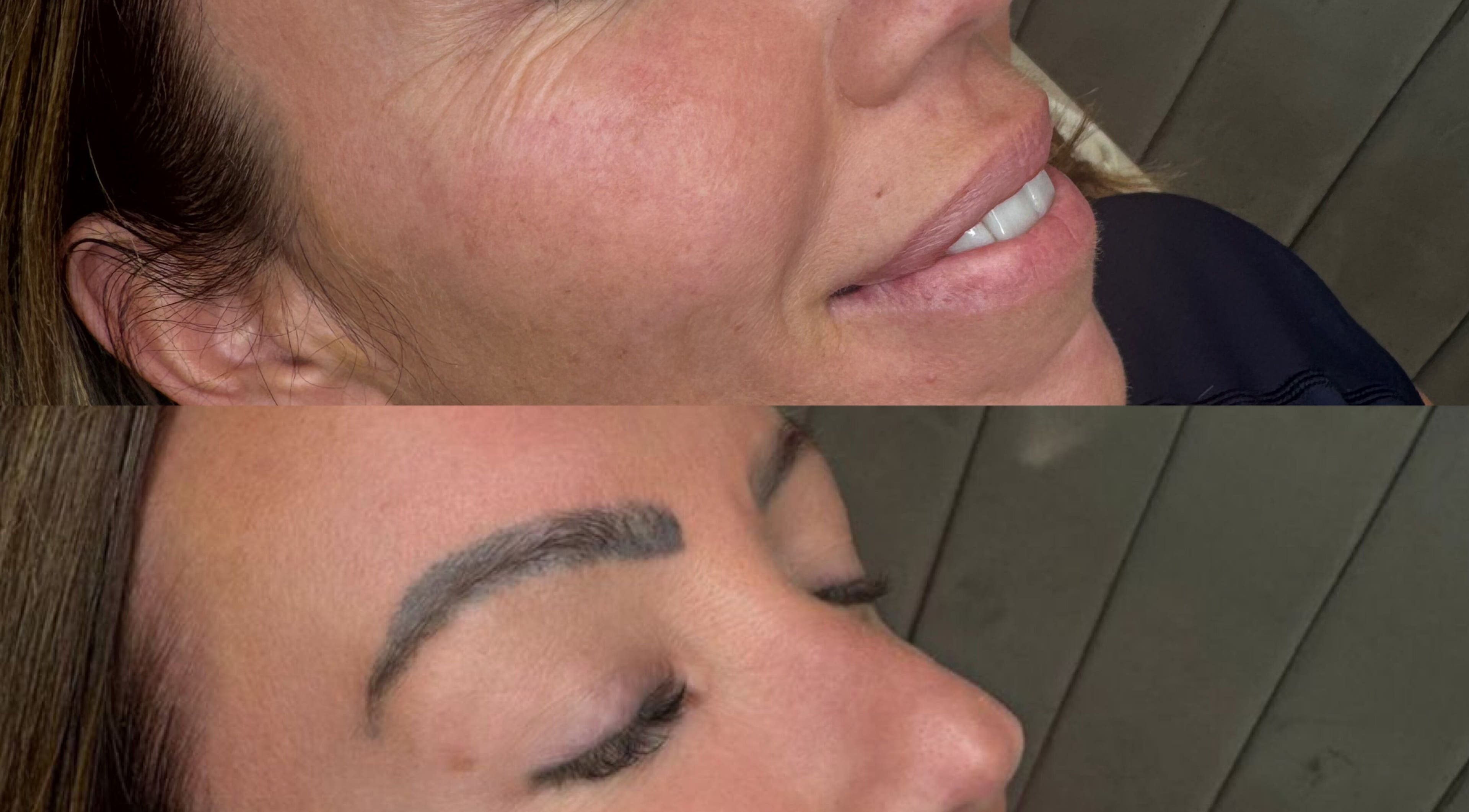 Before and after skin treatment at Glowology clinic, Bolton, England, GB highlighting improved complexion.