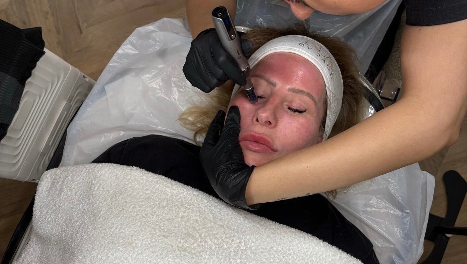 A client receives a rejuvenating HydraGlow facial at The Rejuvenation Room Birmingham, England, GB.