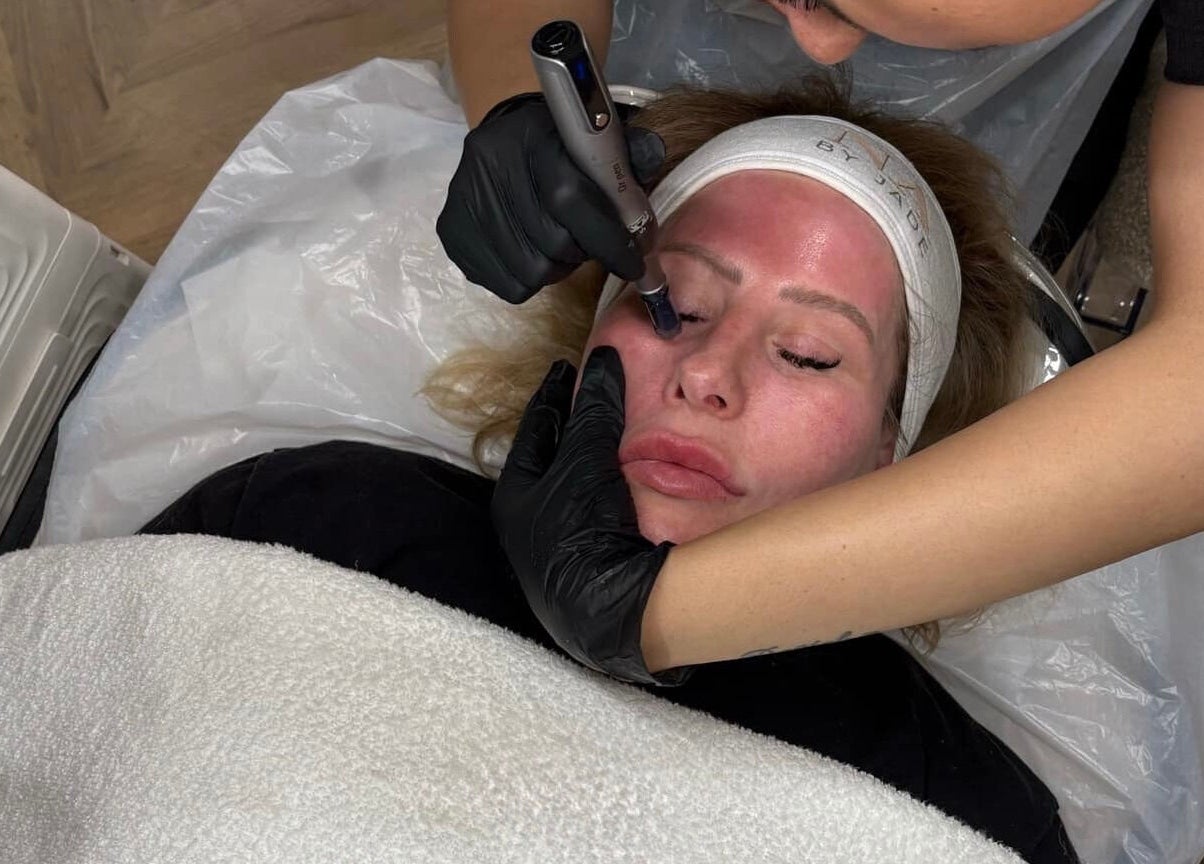 A client receives a rejuvenating HydraGlow facial at The Rejuvenation Room Birmingham, England, GB.