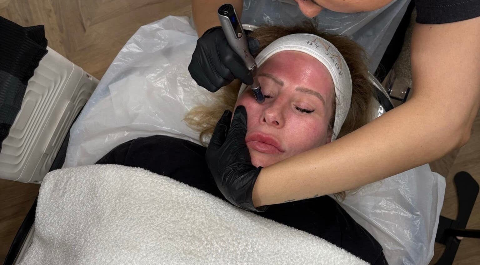 A client receives a rejuvenating HydraGlow facial at The Rejuvenation Room Birmingham, England, GB.