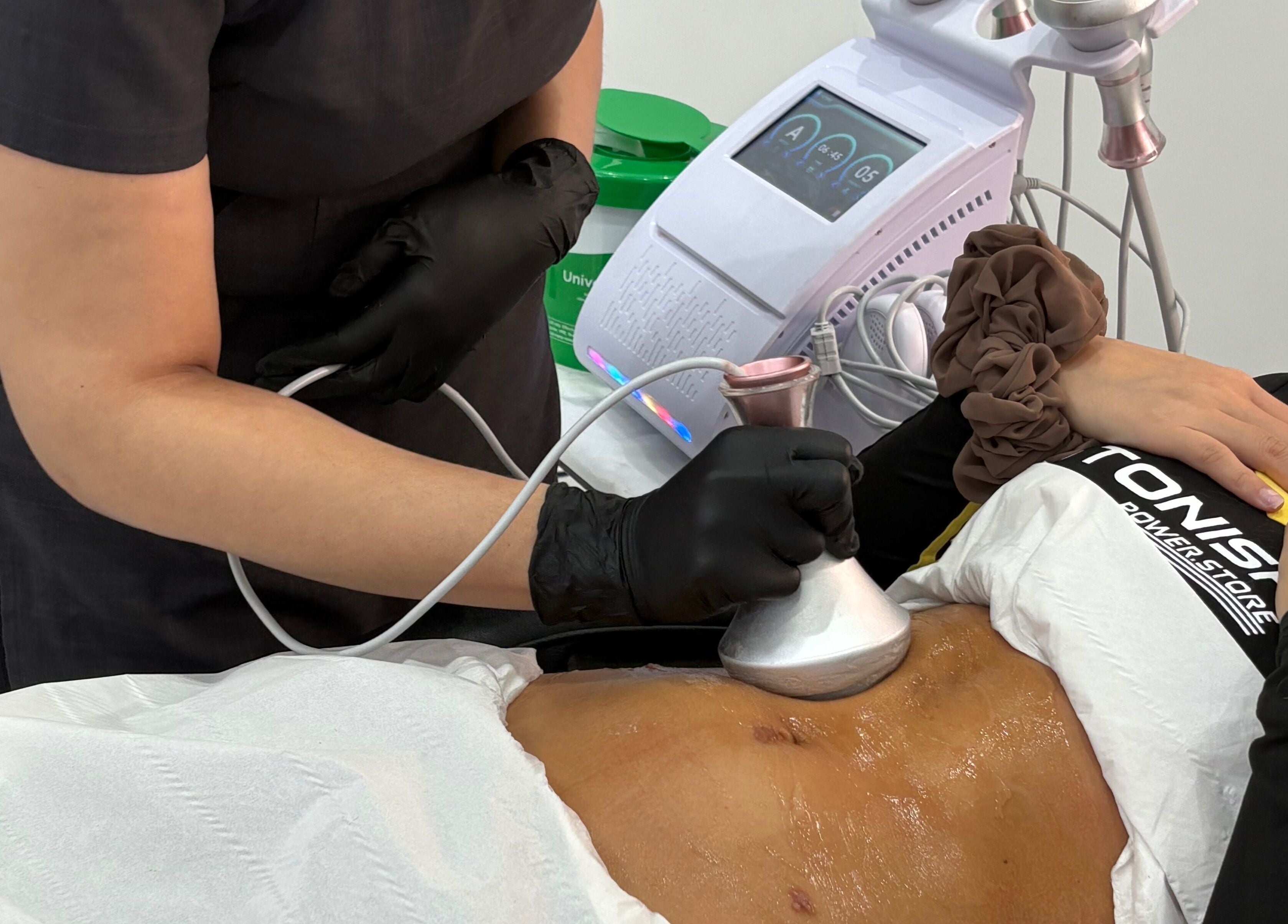 Body contour treatment at The Rejuvenation Room Birmingham, England, GB offering advanced wellness therapies.