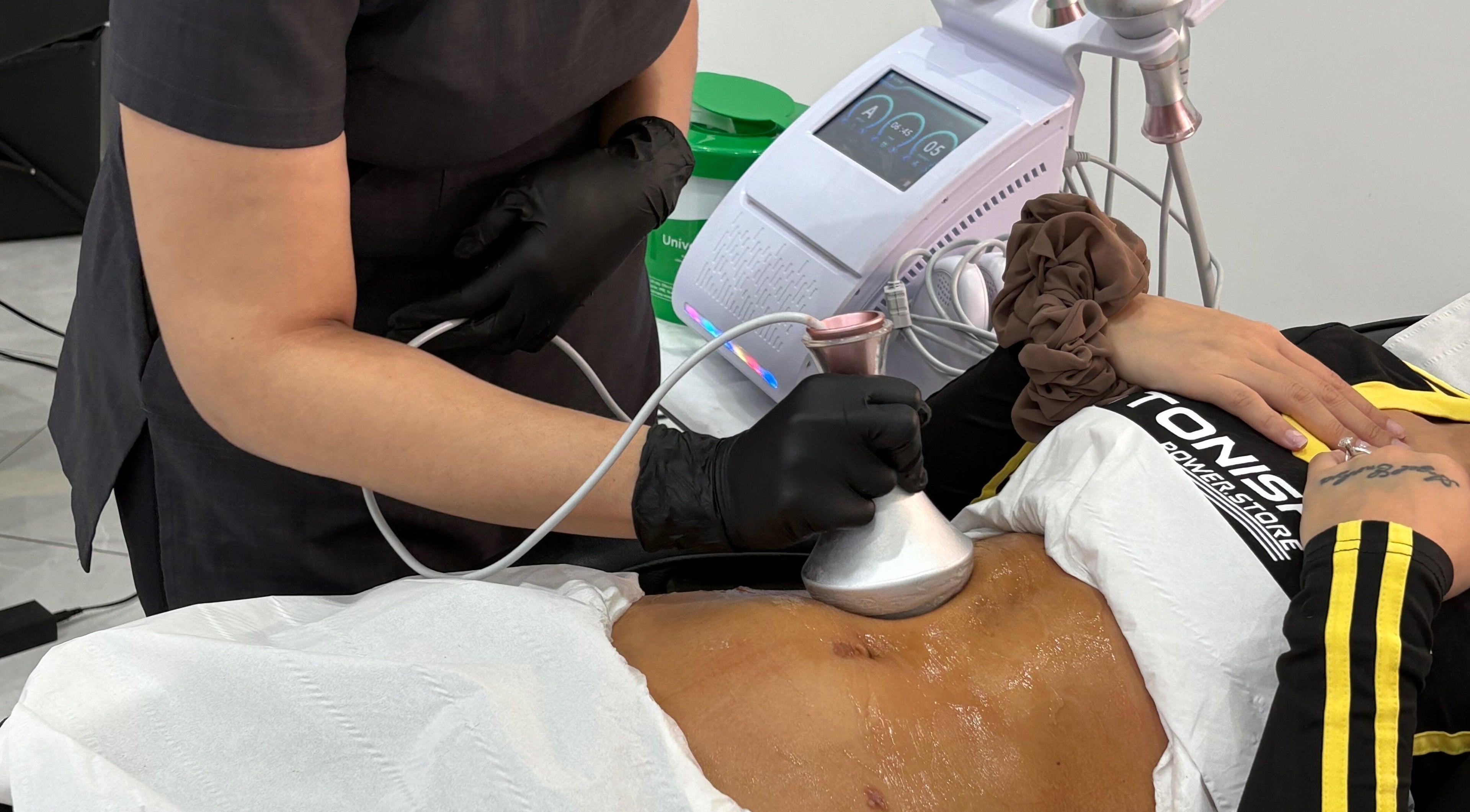 Body contour treatment at The Rejuvenation Room Birmingham, England, GB offering advanced wellness therapies.