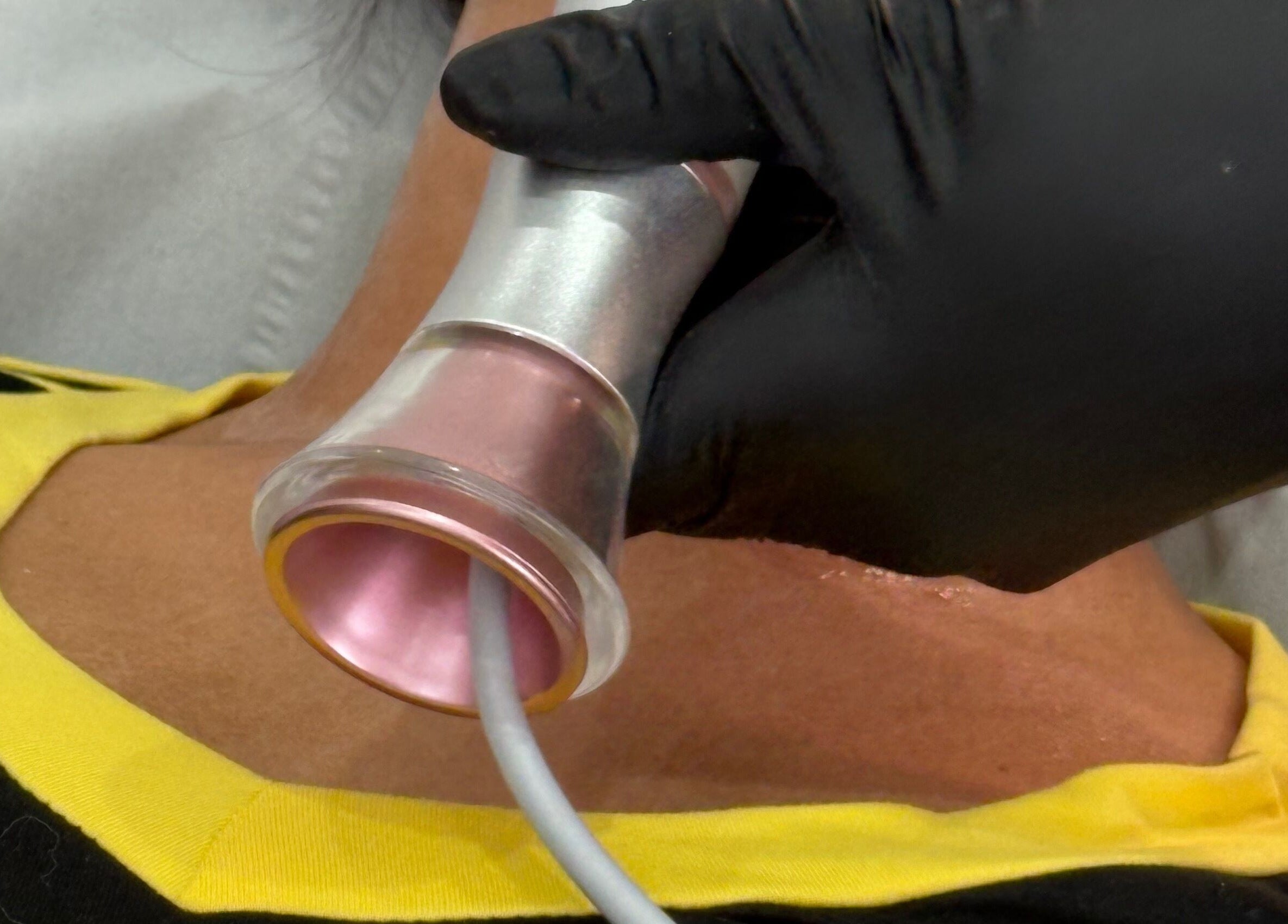 Advanced neck treatment with a modern device at The Rejuvenation Room Birmingham, Birmingham, England, GB.