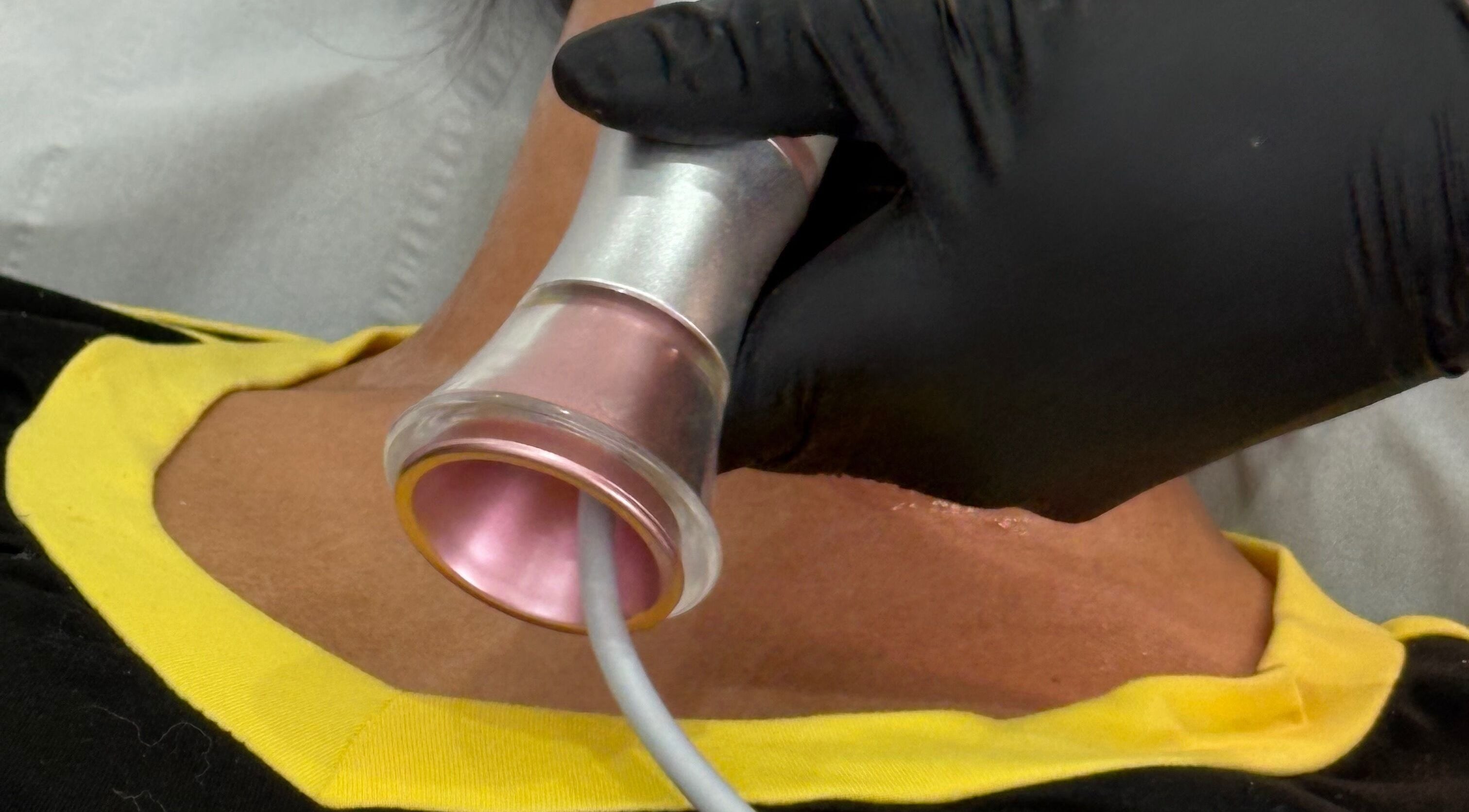 Advanced neck treatment with a modern device at The Rejuvenation Room Birmingham, Birmingham, England, GB.