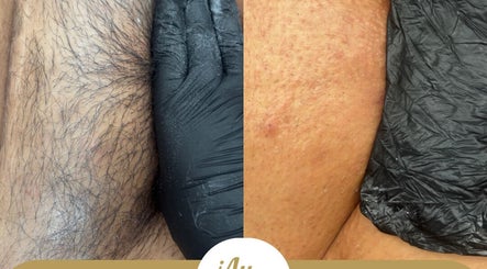 Before and after depilation by ¡Ay, Cera! Depilaciones in La Piedad De Cabadas, Michoacán, MX.