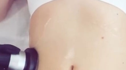 Body contouring procedure at StaceysContour, Wolverhampton, England, GB, showcasing advanced treatment techniques.
