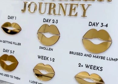 Lip filler journey chart at Masterclass by G Aesthetics, Wilmslow, England, GB, showcasing treatment stages.