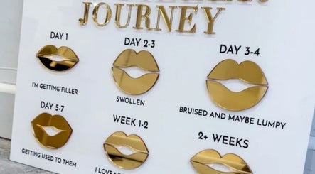 Lip filler journey chart at Masterclass by G Aesthetics, Wilmslow, England, GB, showcasing treatment stages.