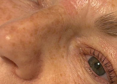 Closeup of revitalized skin at Beauty by Charlene, Edinburgh, Scotland, GB.
