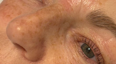 Closeup of revitalized skin at Beauty by Charlene, Edinburgh, Scotland, GB.