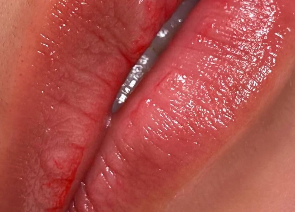 Labios cuidados y brillantes tras tratamiento en Kyiscejas, Barcelona, Catalunya, ES.