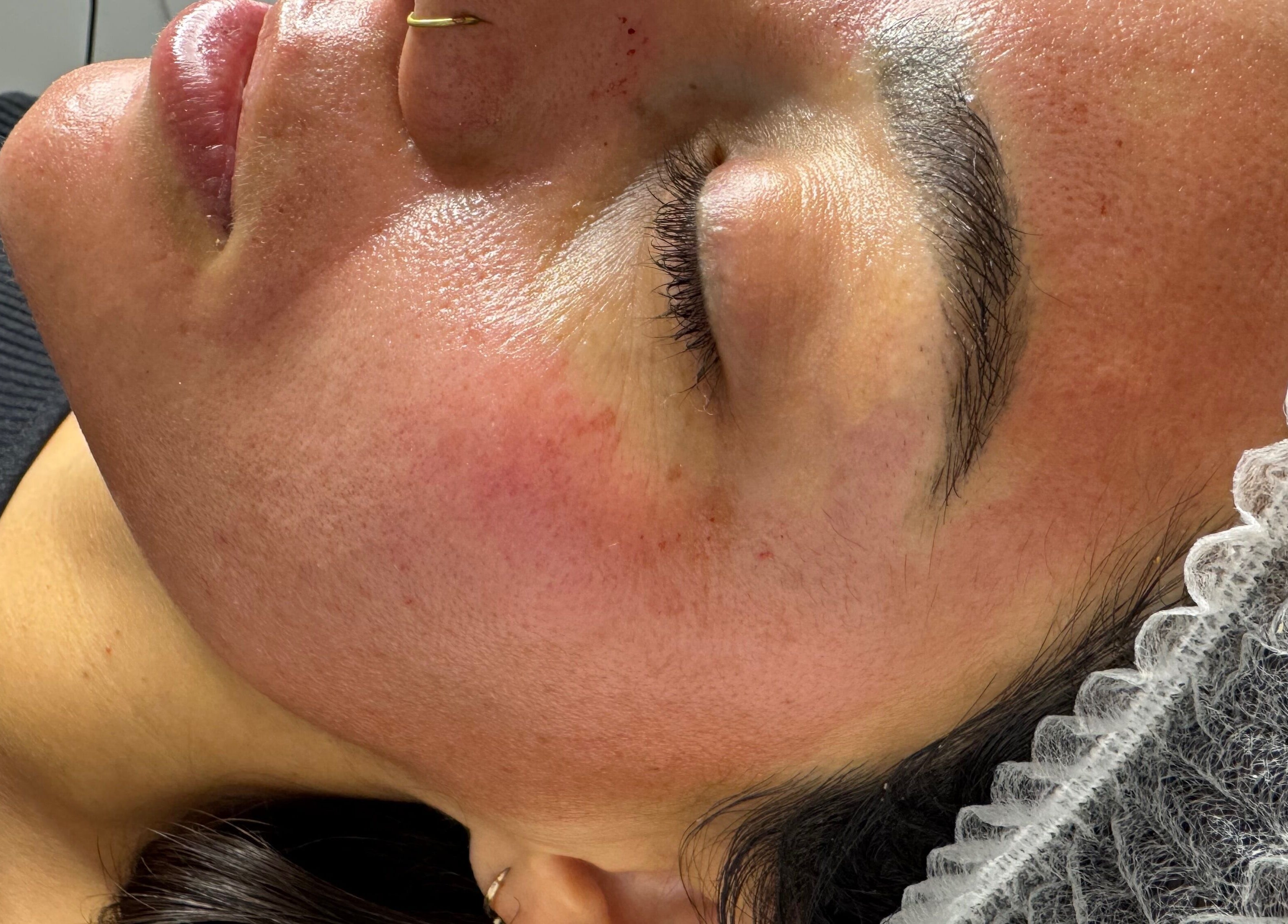 Client receiving facial treatment at Lashes By Juli, Rockdale, New South Wales, AU.