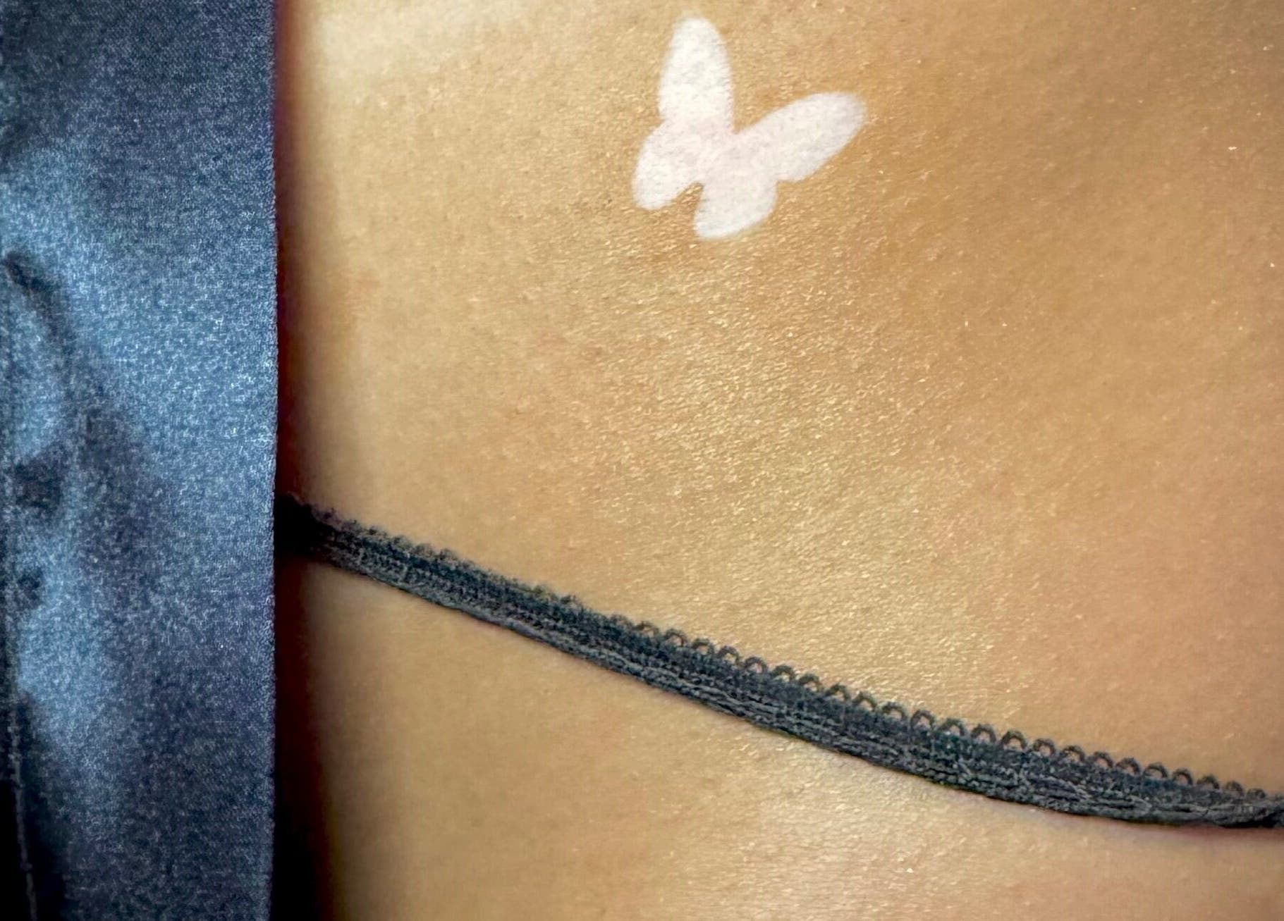 Butterfly tan line on skin, showcasing tanning service at Tan with Topps, Torquay, England, GB.