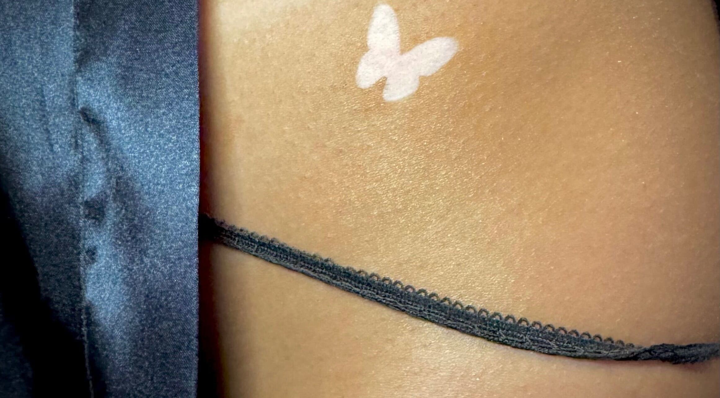 Butterfly tan line on skin, showcasing tanning service at Tan with Topps, Torquay, England, GB.