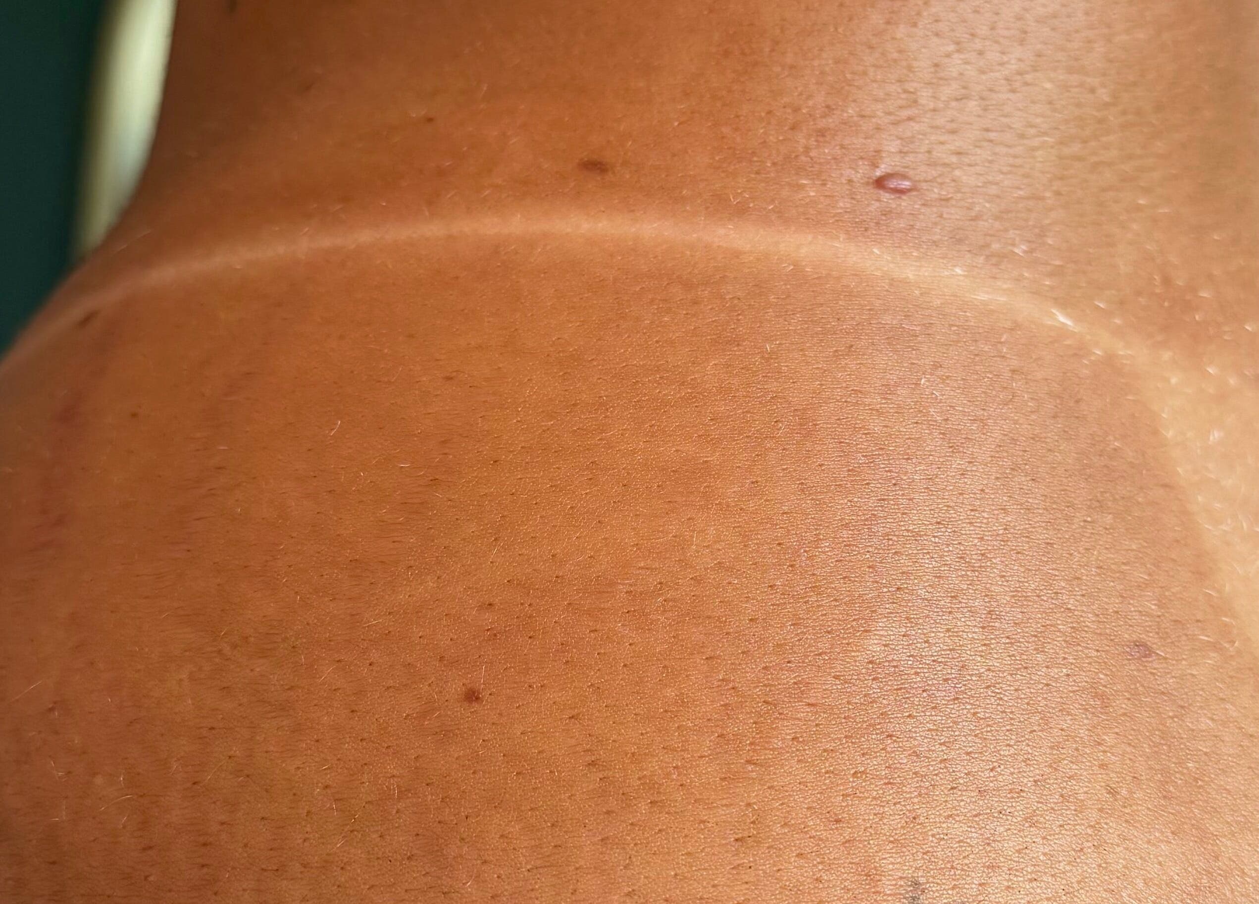 Close-up of a sun-kissed tan line at Tan with Topps, Torquay, England, GB, highlighting natural skin tone.