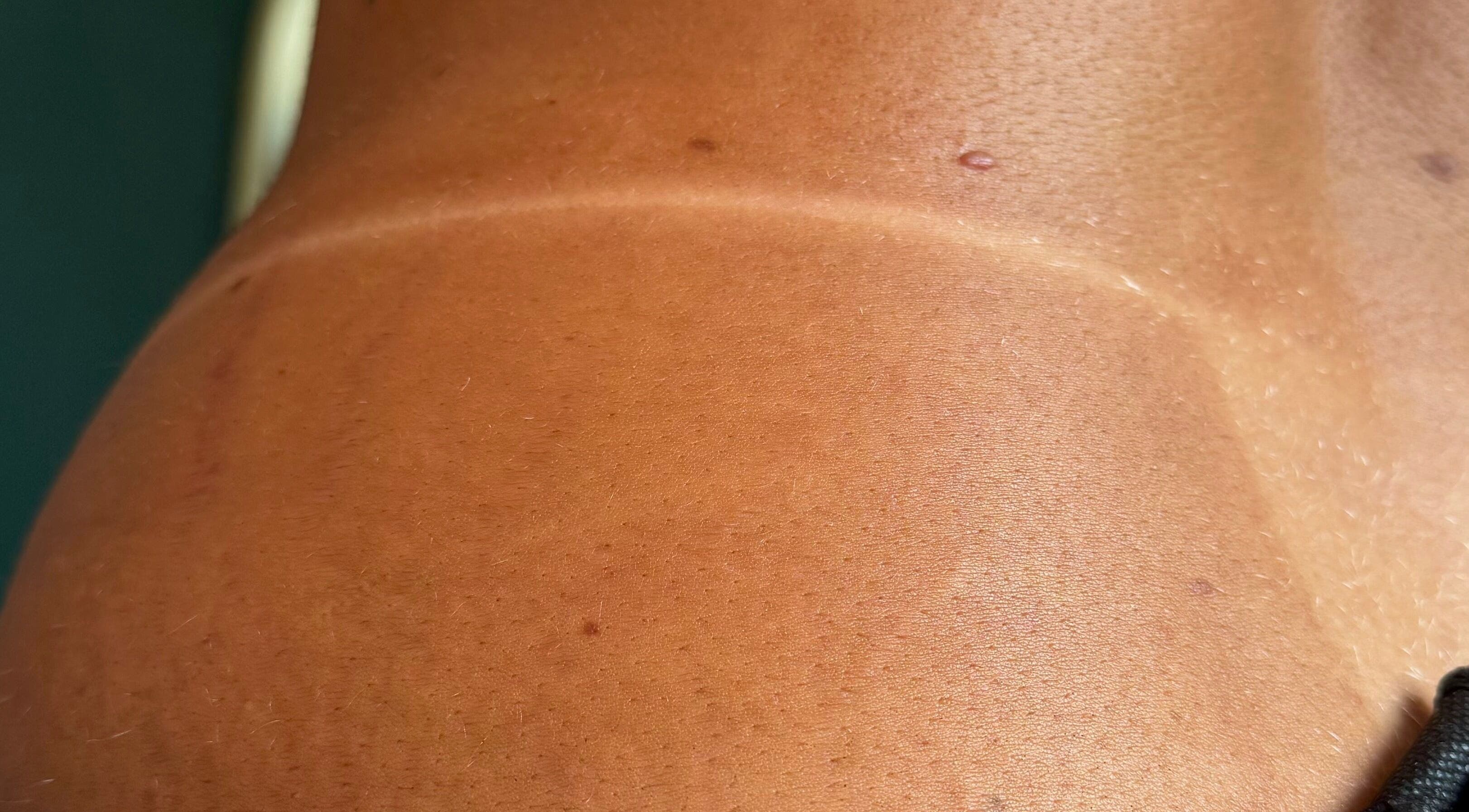 Close-up of a sun-kissed tan line at Tan with Topps, Torquay, England, GB, highlighting natural skin tone.
