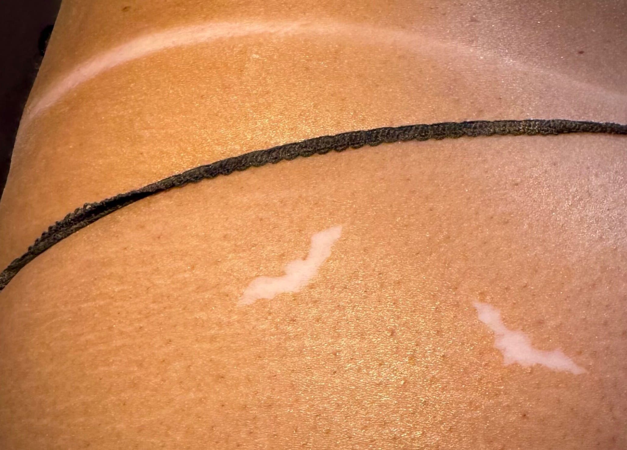 Close-up of beautifully tanned skin at Tan with Topps, Torquay, England, GB, showcasing sun-kissed tones.