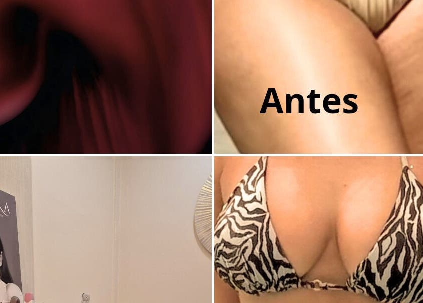 Sessão de beleza antes/depois em Terapeuta Ana Martinez, Matosinhos, Porto, PT.