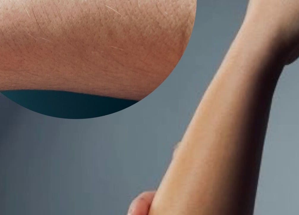 Рука до и после процедуры в Sugaring_vi_tan, София, Област София, BG, показывающая гладкость кожи.