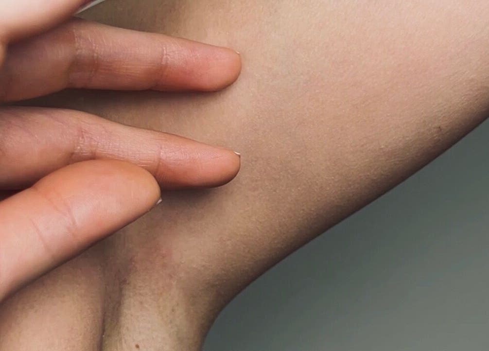 Рука касается гладкой кожи после процедуры в Sugaring_vi_tan, София, Област София, BG.