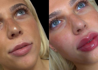 Close-up of enhanced lips and eyes at Casa de Luxe Las Vegas, Nevada, US beauty venue.