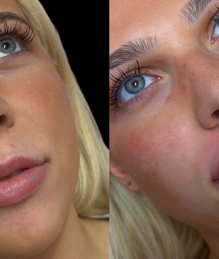 Close-up of enhanced lips and eyes at Casa de Luxe Las Vegas, Nevada, US beauty venue.