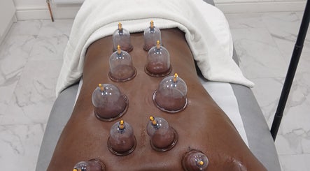 Cupping therapy at JA Sports Injuries, Oldbury, England, GB enhances recovery and wellness.