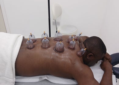 Cupping therapy at JA Sports Injuries in Oldbury, England, GB, enhancing healing and relaxation.