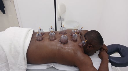 Cupping therapy at JA Sports Injuries in Oldbury, England, GB, enhancing healing and relaxation.