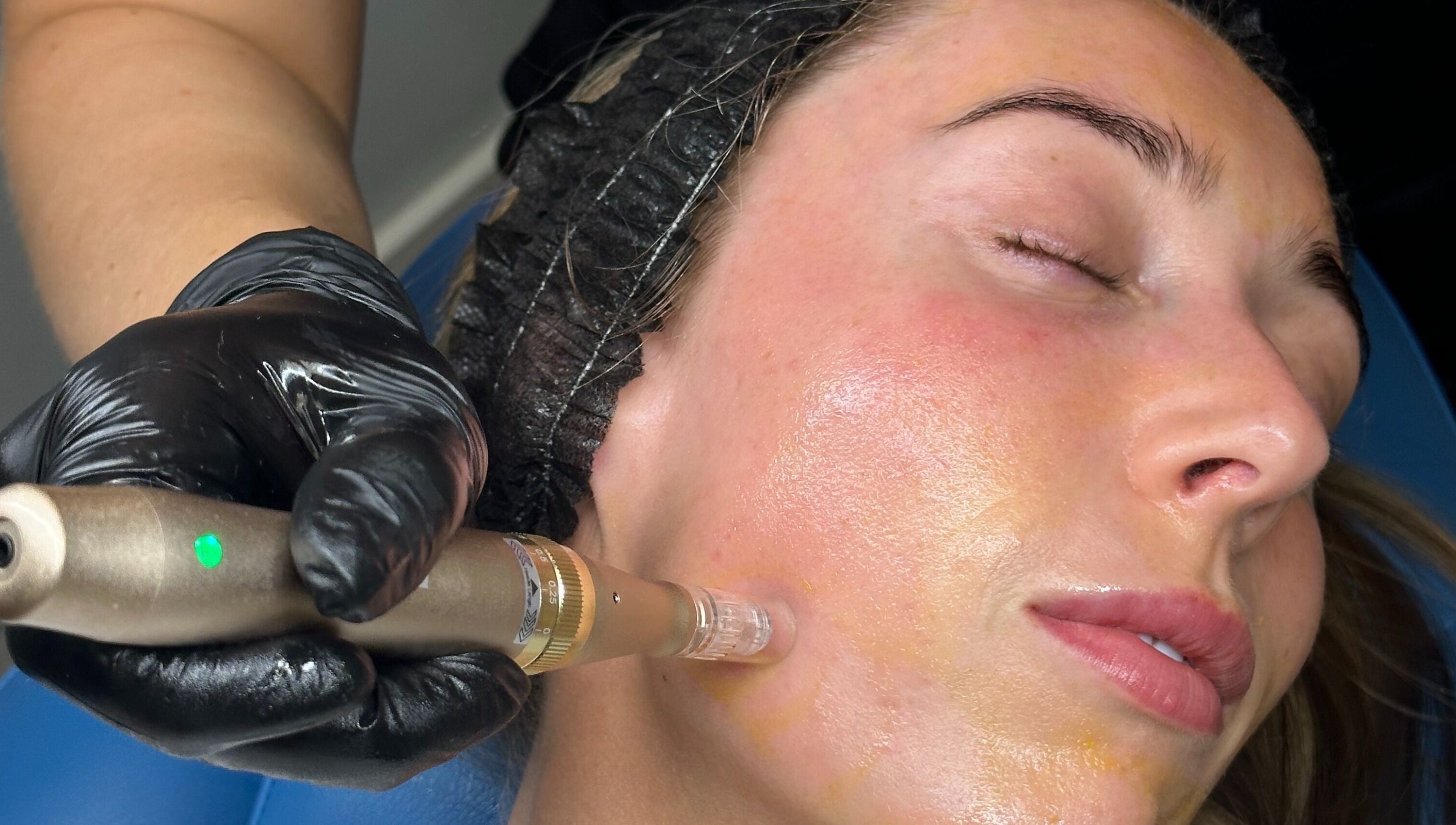 Facial treatment at Skinology Studio in Evesham, England, GB enhances skin glow and texture.