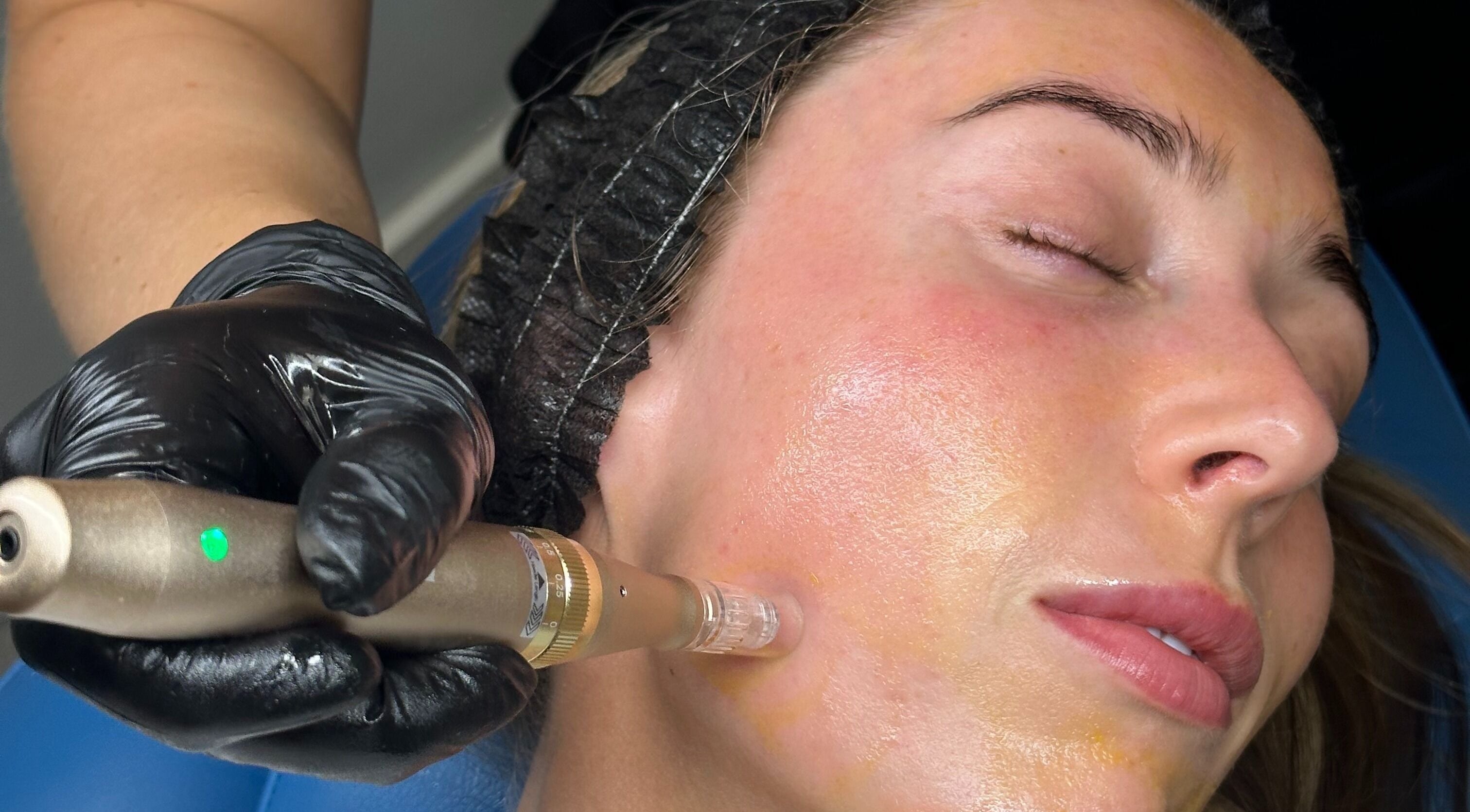 Facial treatment at Skinology Studio in Evesham, England, GB enhances skin glow and texture.