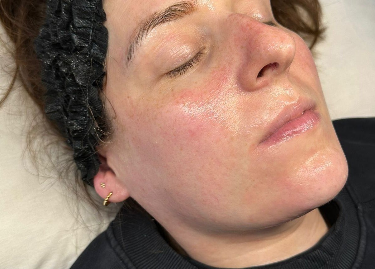 Client with glowing skin after facial at Skinology Studio, Evesham, England, GB.