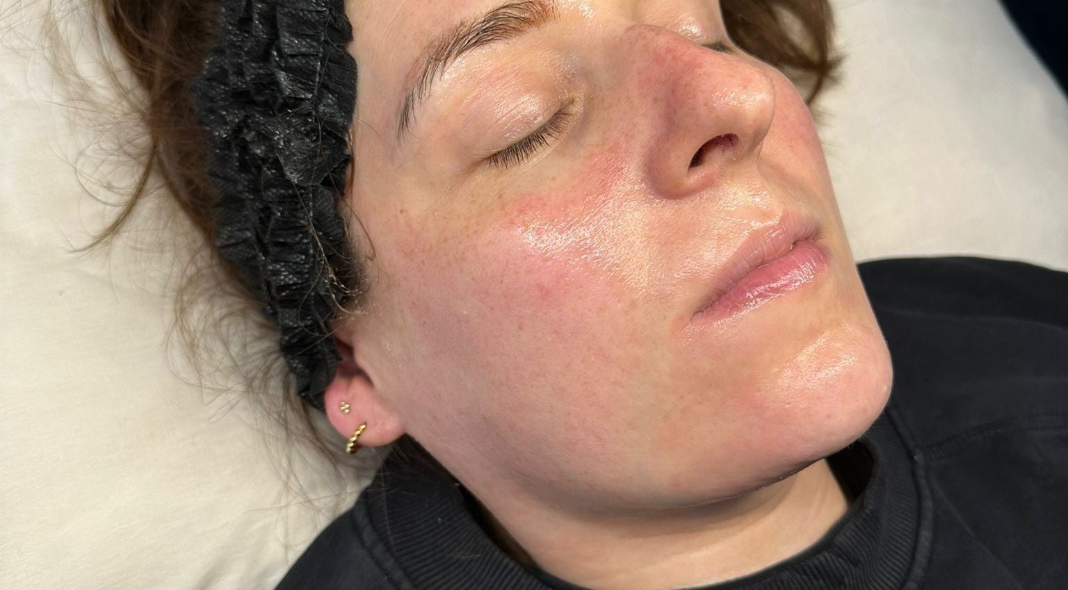 Client with glowing skin after facial at Skinology Studio, Evesham, England, GB.