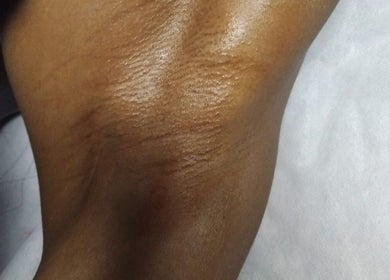 Smooth, moisturized skin surface at Allure Beauty Bar, Springs, Gauteng, ZA.